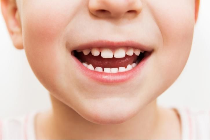 Child Dentistry Banner